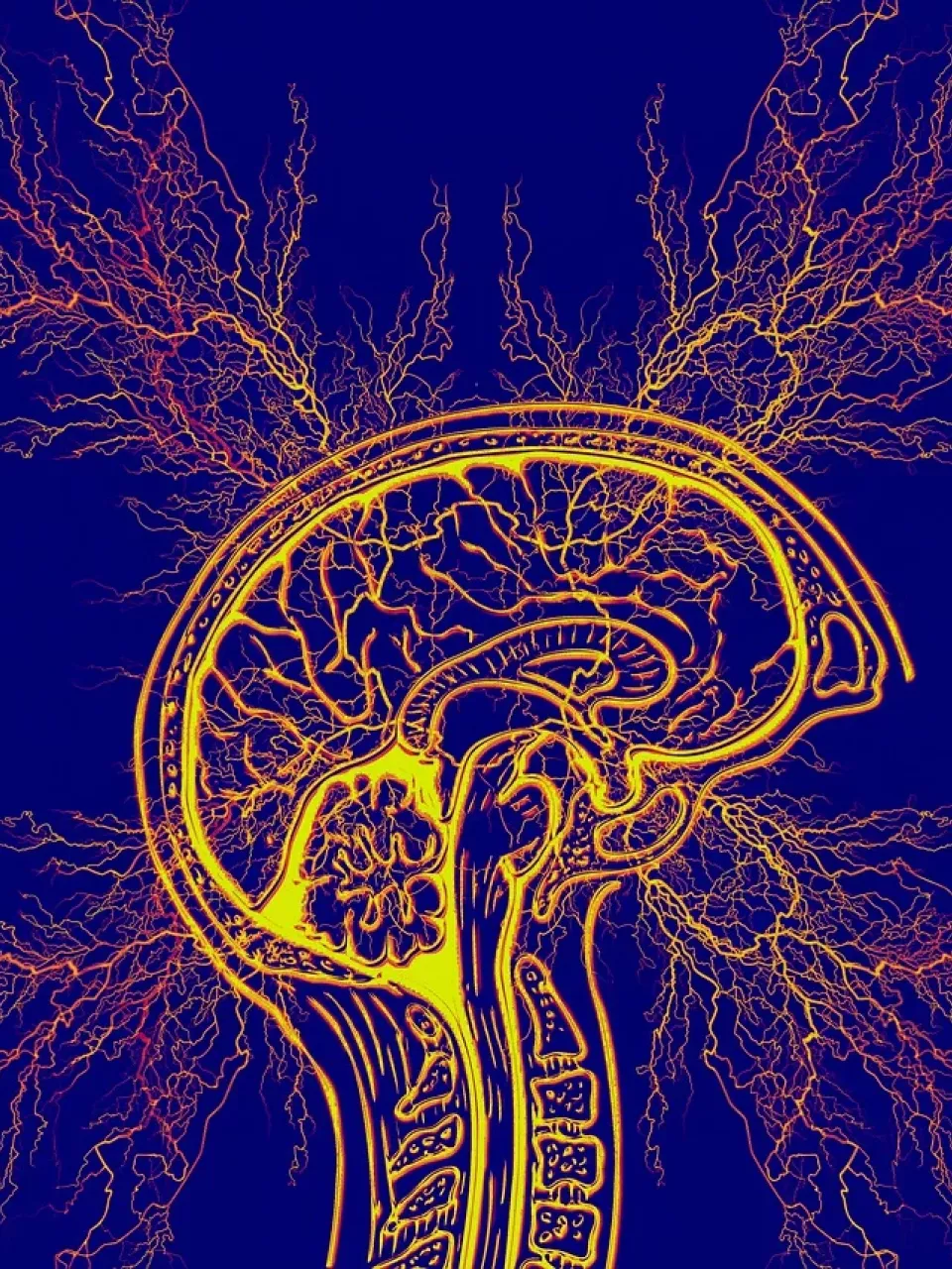 Symbolbild Gehirn mit Nervenverästelungen – Thema neurovaskuläre Erkrankungen und Schlaganfall